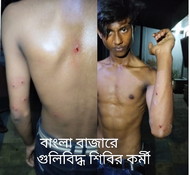 বেগমগঞ্জে ফের গুলিবর্ষণে গুলিবিদ্ধ-৩